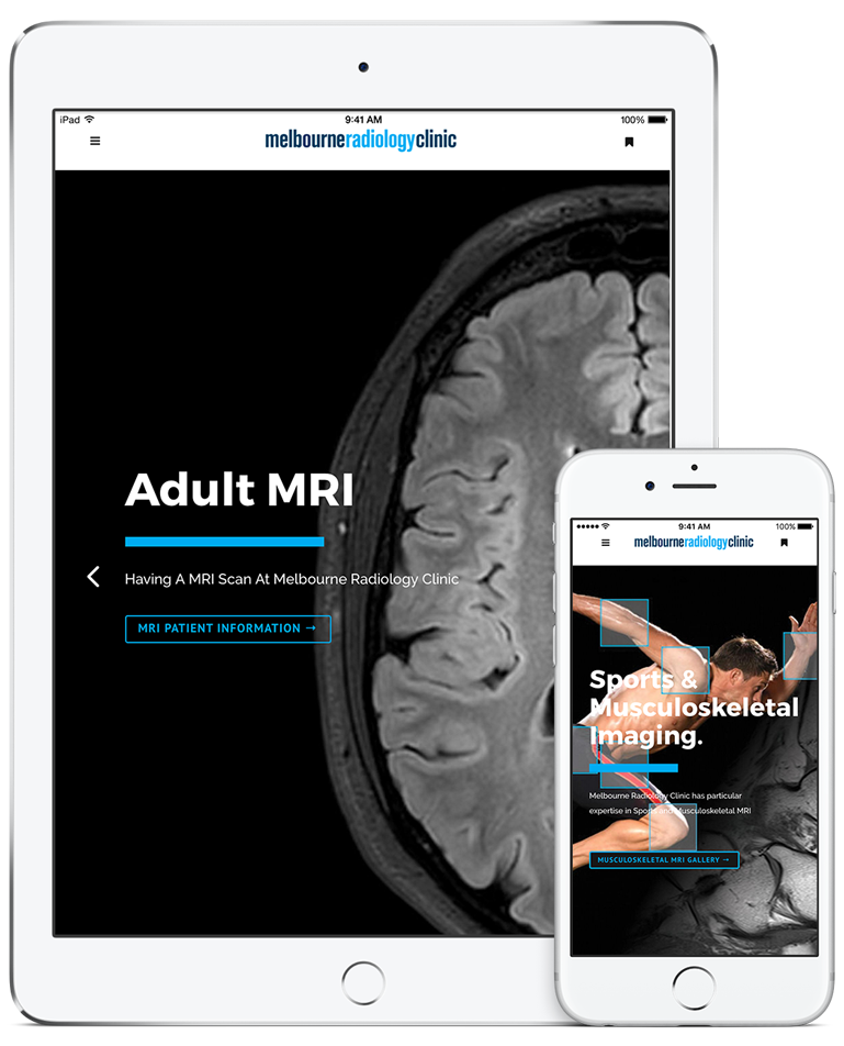 mrimelbournemobileresponsivesite MRI at Melbourne Radiology Clinic