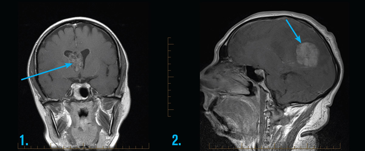 head-and-brain-adult-mri-series-gp-referred-scans