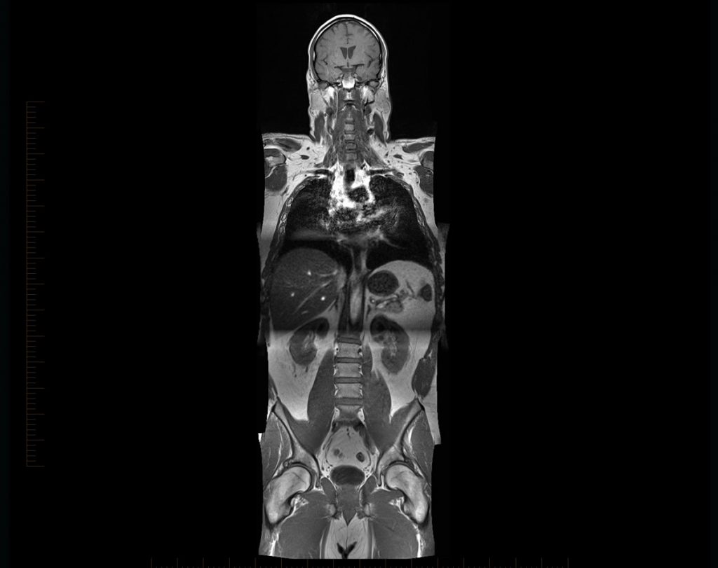 MRI at Melbourne Radiology Clinic Biology Diagrams
