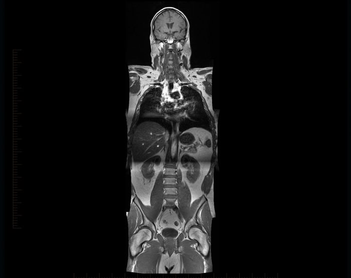 Full Body MRI MRI At Melbourne Radiology Clinic hospital-related-full-form-of-icu-mri-dna-rna-rbc-wbc-opd-ipd-ka