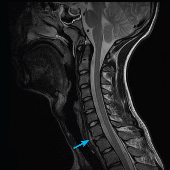 adult-mri-scans-medicare-rebate-items-for-gps-knee-mri-updates-2018