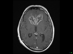 melbourne-radiology-mri-brain-postcontrast-0001