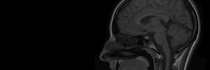 MRI Gallery - Paediatric MRI Series - MRI Brain / Head