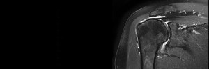 MRI Series - Shoulder - Melbourne Radiology Clinic